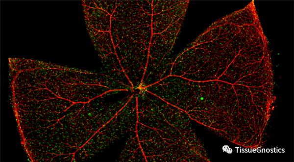 1621933213794917.png 640.png